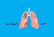 بیماری های تنفسی