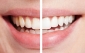 سفید دندان